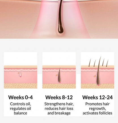 LESCOLTON Advanced LLLT Hair Growth Helmet